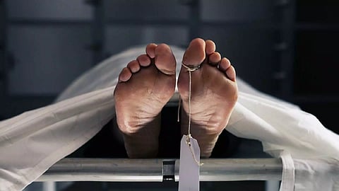 Representative Image