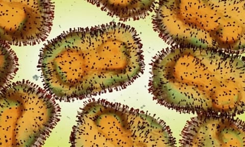 Representative image