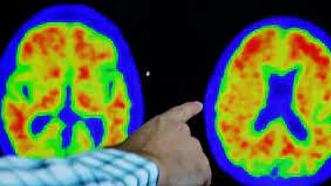 Representative Image (Photo/Reuters)