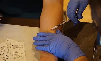 Representative image