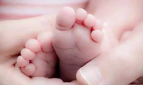 Representative Image