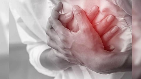 Representative Image