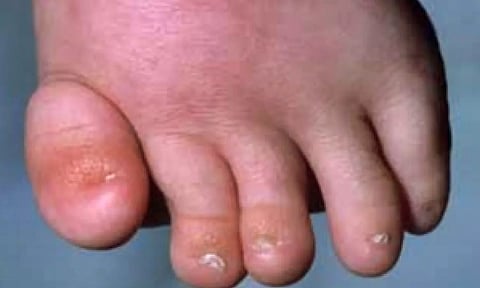 Representative image