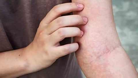 Representative Image (Photo/IANS)