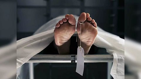 Representative Image