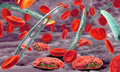 Representative image