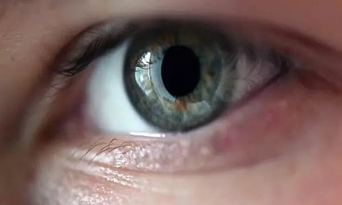 Representative image