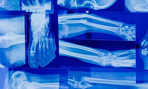 Representative image (Photo: IANS)