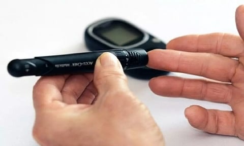 Representative image