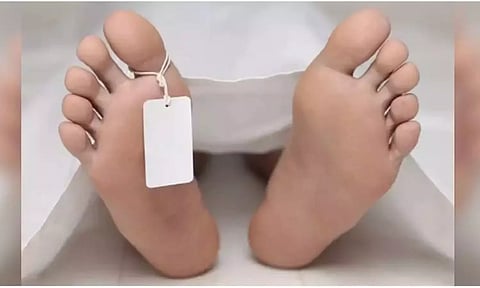 Representative Image