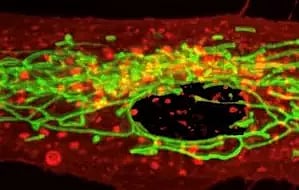 Representative image (IANS)