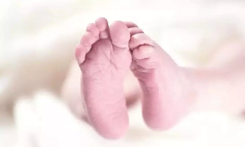 Representative image