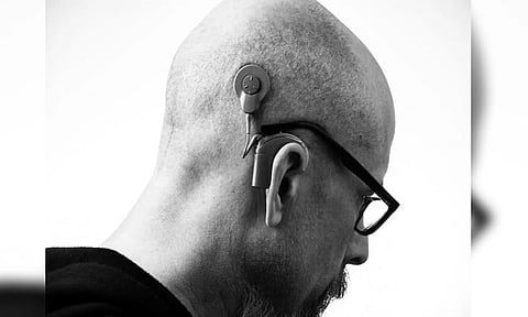 Representative image