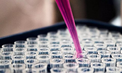 Representative image