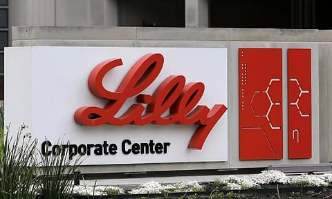 Representative image.