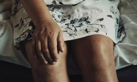 Just 30-min walk can improve blood pressure in women with arthritis