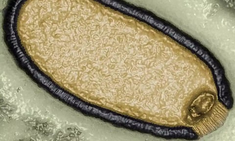 Representative image. (IANS)