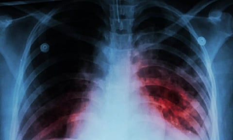 Representative Image (IANS)