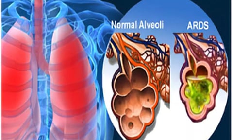 Representative Image (IANS)