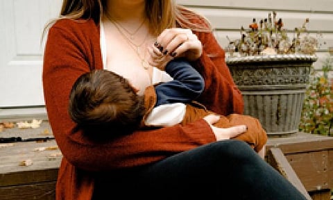 Representative image