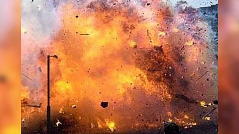 Representative Image&nbsp;