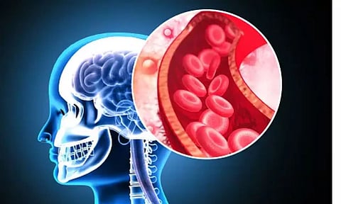 Representative image (Unsplash)