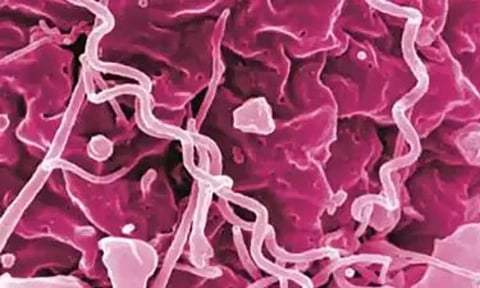 Representative image