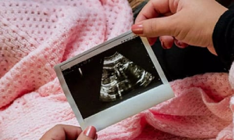 Representative image