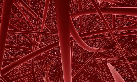 Representative image. (Pixabay)