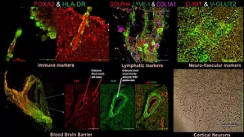 Representative Image (Photo/IANS)