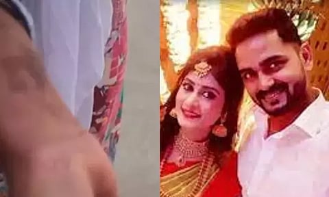 Injuries on 18-year-old victim; Anto Mathivanan and Marlina (Maalaimalar)