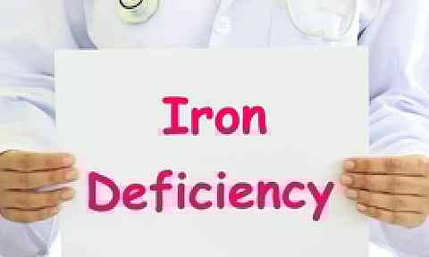 Representative image