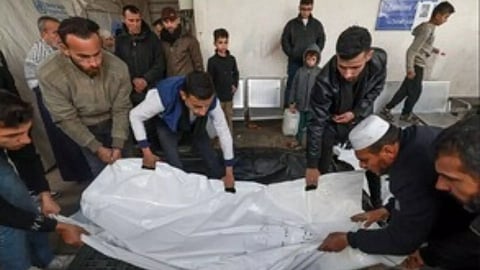 Representative Image