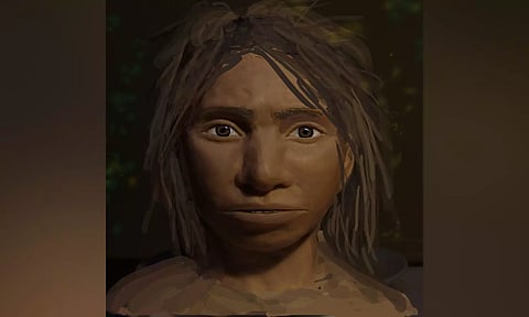 Representative Image