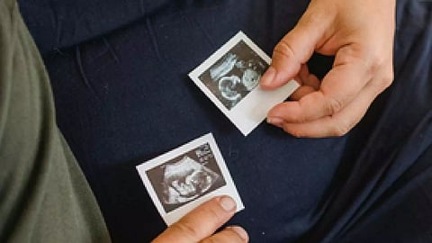 Representative Image (IANS)