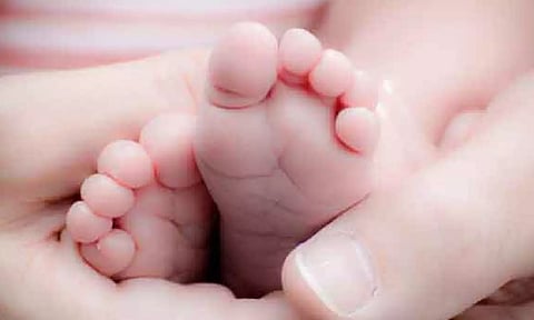 Representative Image