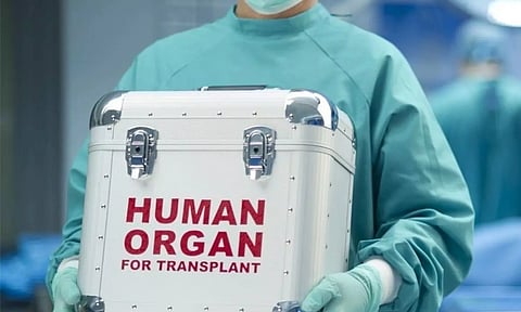 Representative Image