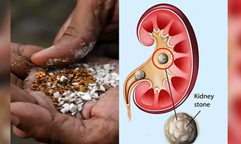 Representative Image (IANS)