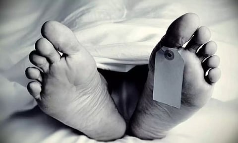 Representative Image