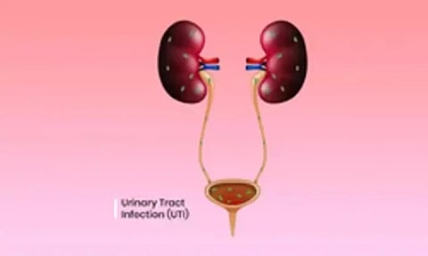 DT Health: Managing urinary problems during soaring summer heat