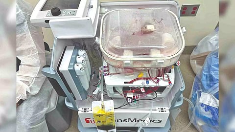 A perfusion machine containing a liver from a deceased donor. The machine essentially pumps blood or an oxygenated fluid through tubes into the blood vessels of a donated organ, preserving it