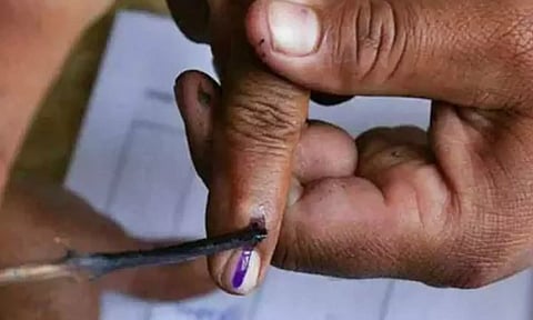 Representative Image