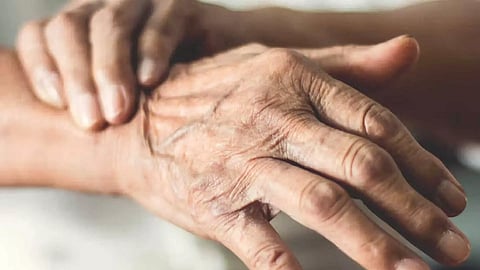 Representative Image