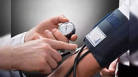 Representative Image