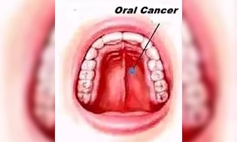 Mouth illustration (IANS)