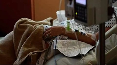 Representative Image