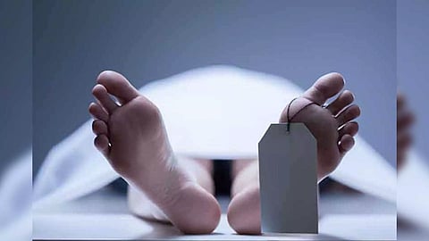 Representative Image