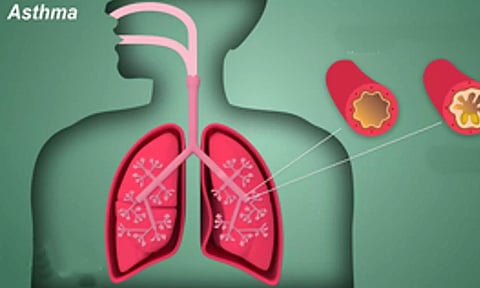 Representative image (IANS)&nbsp;