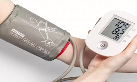 Representative image