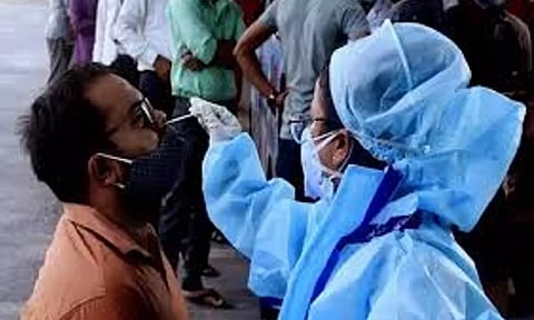 Representative Image